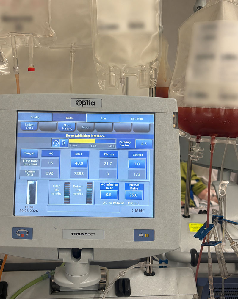 Car-t-therapy-for-lupus-2026_0.jpg