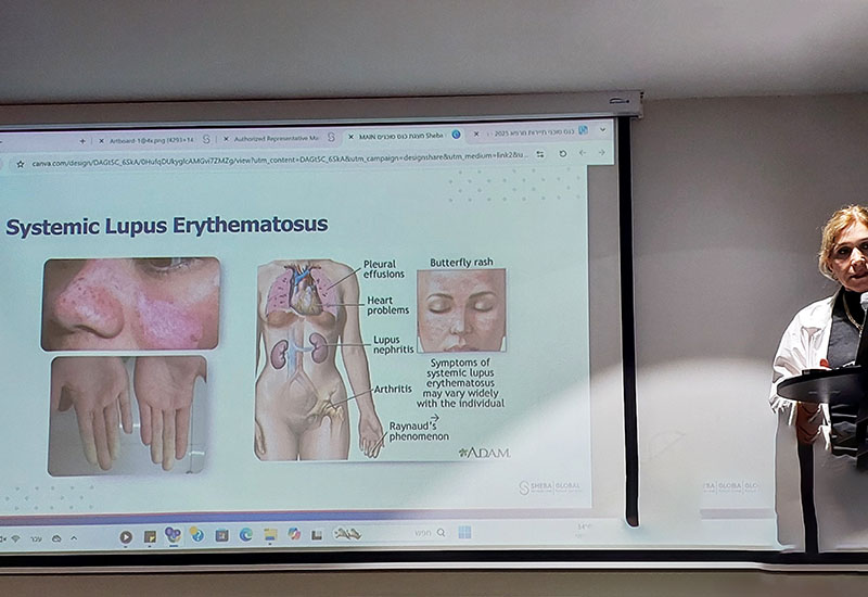 car-t-for-lupus-sle-israel.jpg