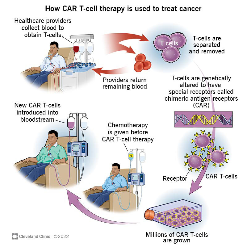 israel-car-t-cell-therapy-sheba.jpg